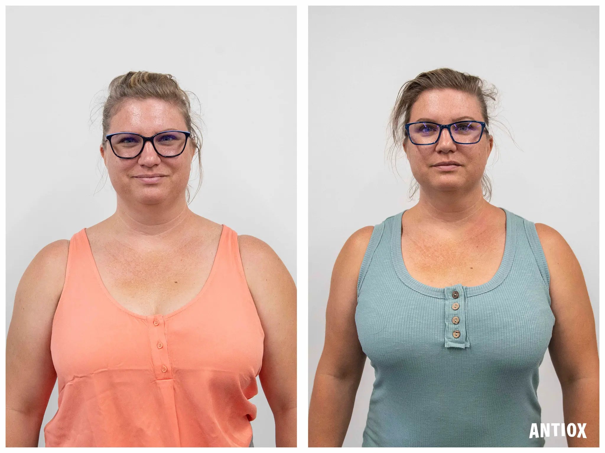 ANTIOX client before-and-after comparison in coral and teal tops, with her face visible