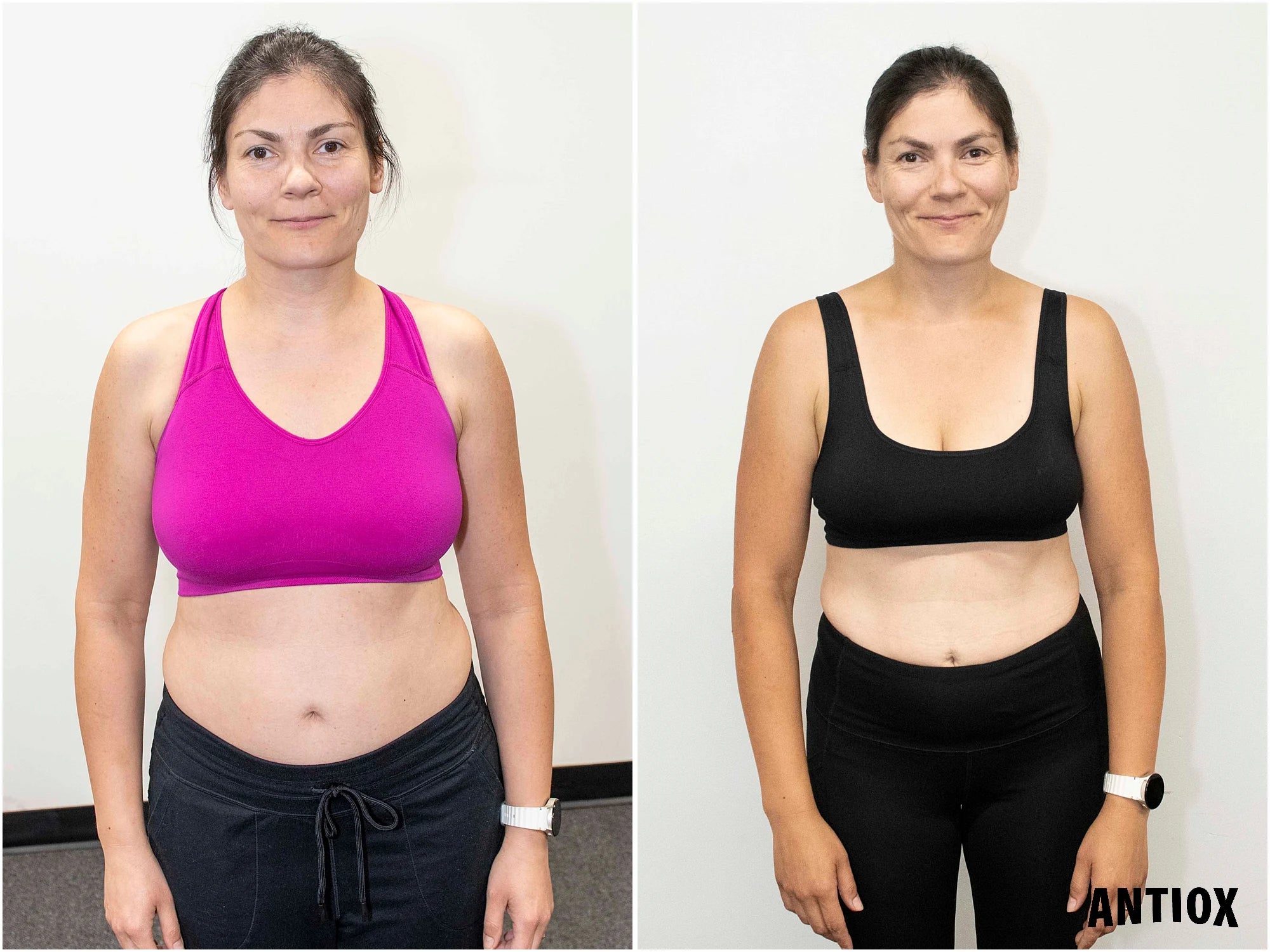 ANTIOX client front-facing before-and-after comparison in pink and black exercise tops